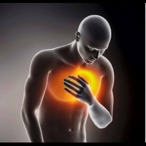 Meet your Posher, Israel lepiz